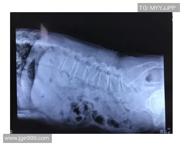 基耶利尼在比赛中神奇扭伤腰部，仍坚持坚持完赛荣获万千赞许